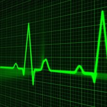Defining systematic internaliser under MiFID II